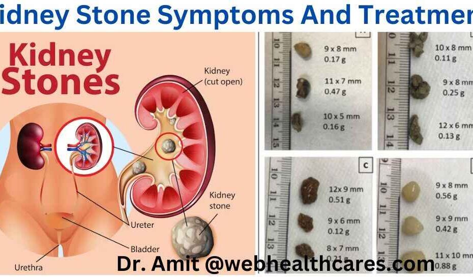 kidney stone photos, image