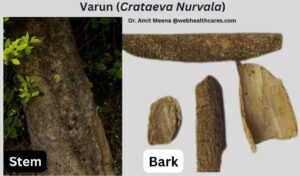 Ayurveda herbs Varun break down kidney stones